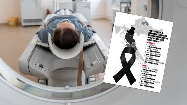 Ovo je karta najteže bolesti po županijama: Oboljelih od raka najviše kod Šibenika i Karlovca