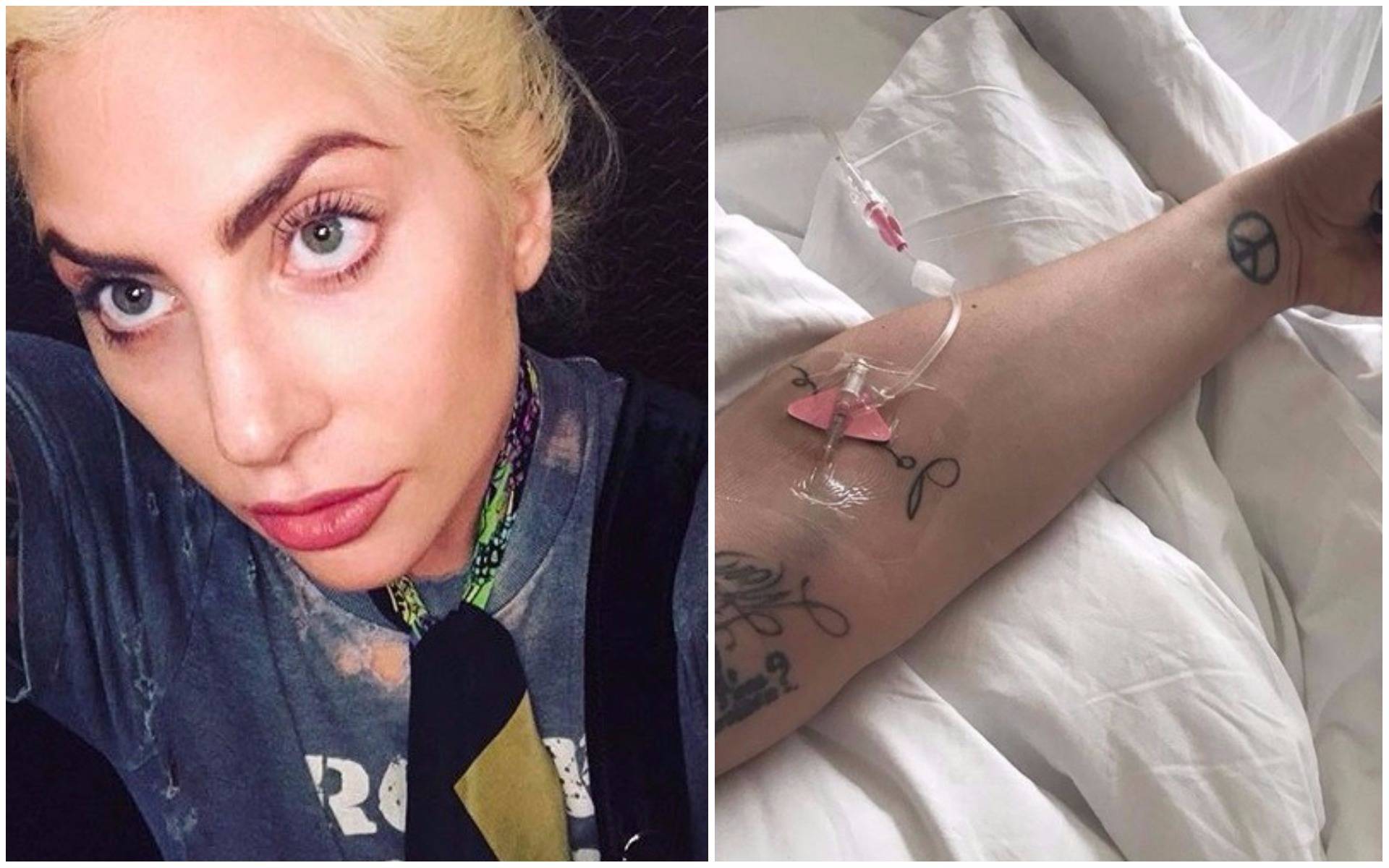Otkazala je turneju: Lady GaGa je u bolnici zbog teških bolova