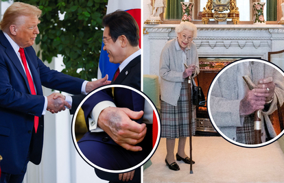 Trump pokazao plavu modricu na desnoj šaci: Sličnu je imala i kraljica Elizabeta II. prije smrti