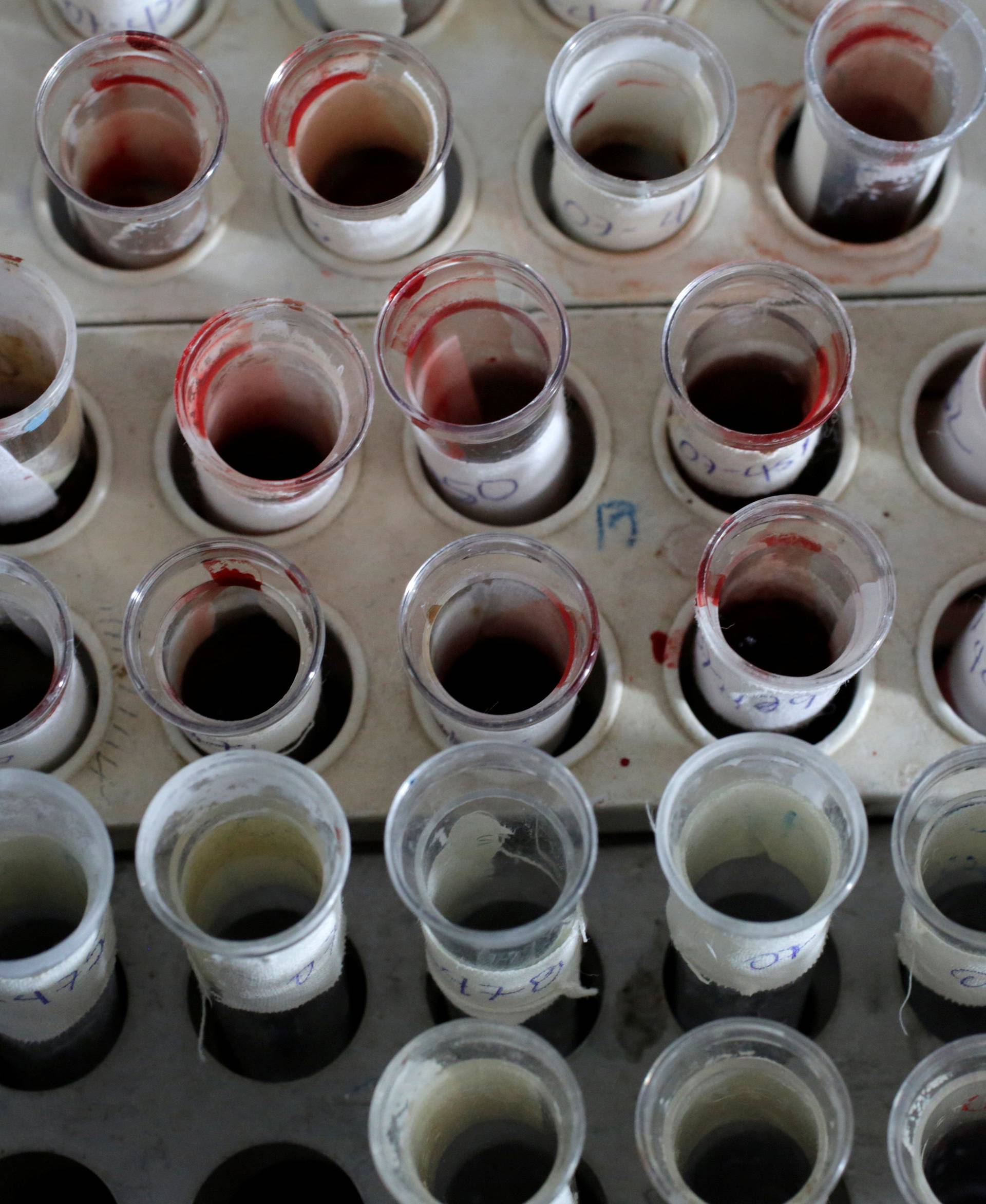 Testing tubes full of blood are seen during a blood donation at a school as part of the celebrations for Cuba's former President Fidel Castro's upcoming 90th birthday in Artemisa province, Cuba