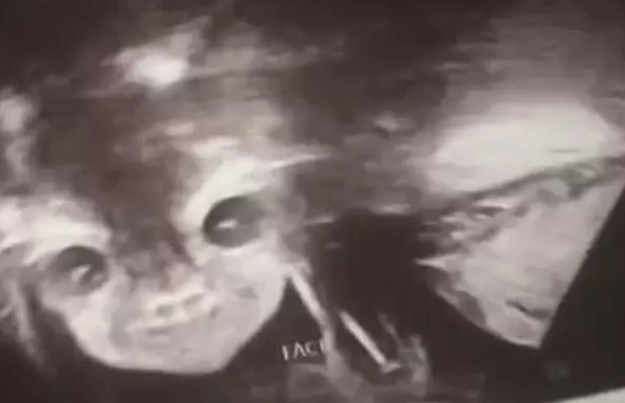 Šokirana slikom s ultrazvuka: 'Moja beba izgleda kao demon'