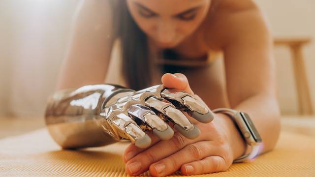 'Svjedočimo bioničkim udovima na razini znanstvene fantastike'