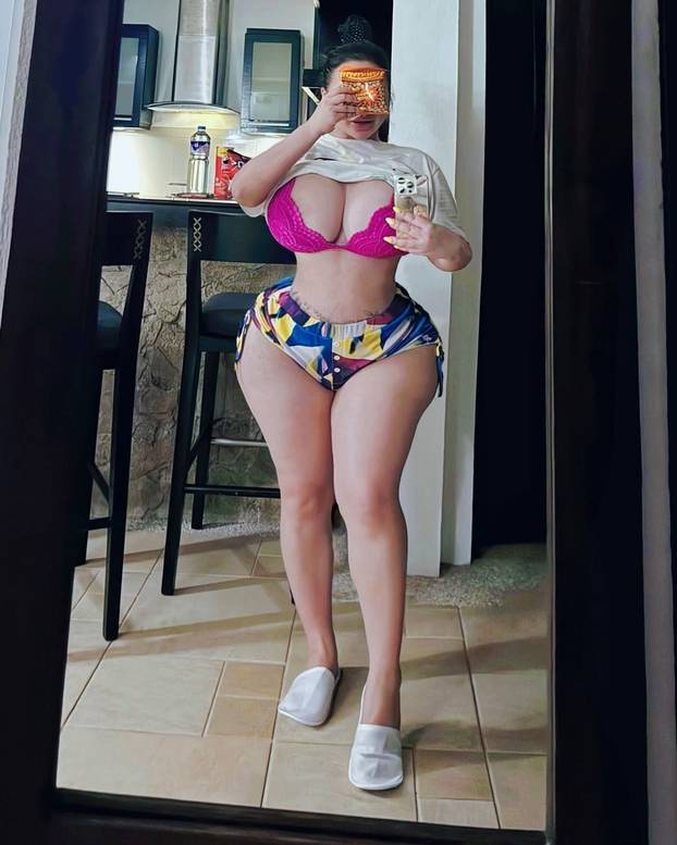 FOTO Mila želi ukloniti rebra zbog struka: 'Po dva sa svake strane da mi guza izgleda šire'