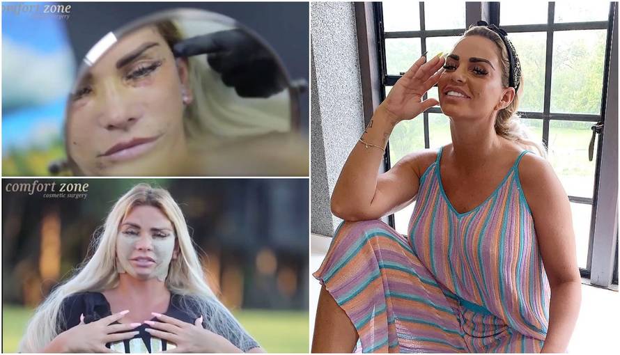 Starleta opet šokira: Cijela je u zavojima, smanjila je i grudi...