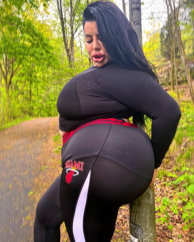 FOTO Stražnjica mi teži 45 kila, no već imam u planu sljedeću operaciju, želim imati najveću!