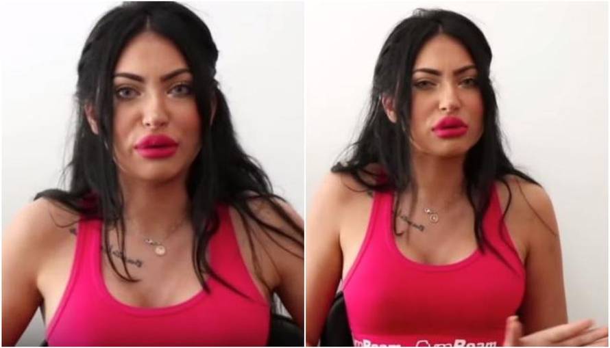 Tako mlade, a tako napumpane: Hana i Mandarine trče pod nož