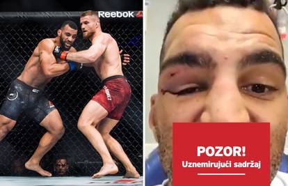 Trebat će mu dobar zubar: UFC borac ostao bez nekoliko zubi