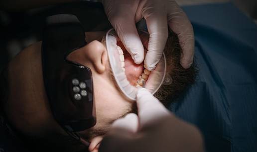 Parodontologija uz vrhunsku njegu u Poliklinici Minerva