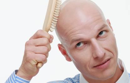 Dan ćelavih muškaraca: Oni mogu biti itekako muževni!