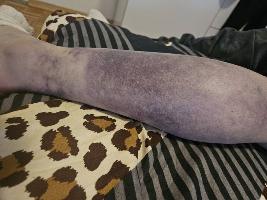 Super Silva za 24sata: Znam tko me napao, bilo je iznenada i s leđa. Jedna noga mi je uništena