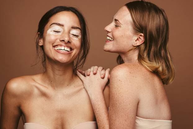 Portrait,Of,Two,Happy,Women,With,Skin,Pigmentation,Together,Against