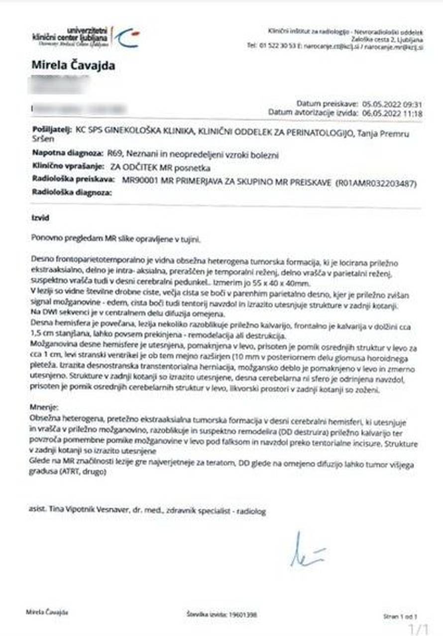 Sedam netočnih tvrdnji: Što kaže Vili Beroš, a što nalazi Mirele Čavajde o njenoj bebi?