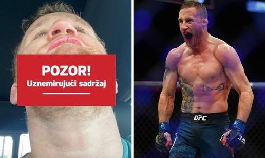 Rane s priprema za Khabiba: Gaethje išao na šivanje brade