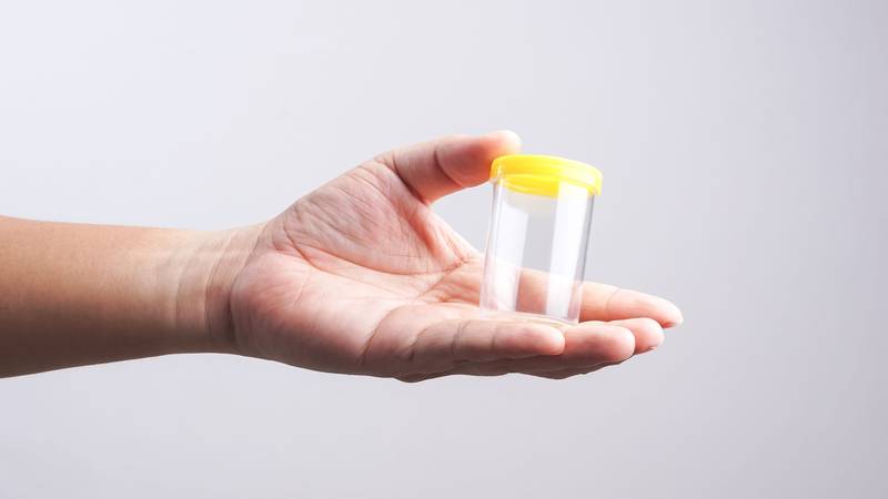 Ovi gadgeti mogu analizirati vaše tijelo… iz urina