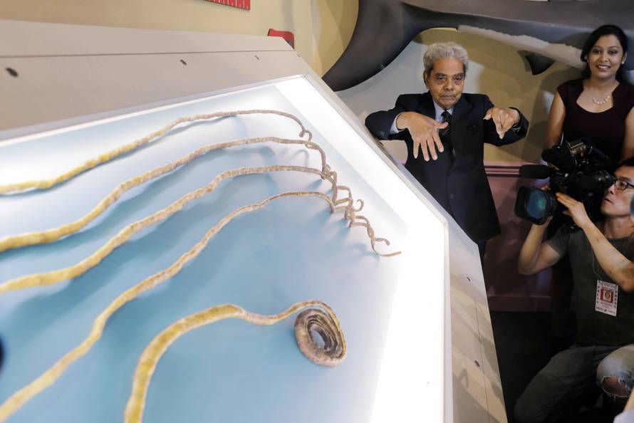 Shridhar Chillal of India displays his newly cut fingernails at an announcement that the five fingernails he grew for 66 years will be displayed in Ripley's Believe it or Not in New York