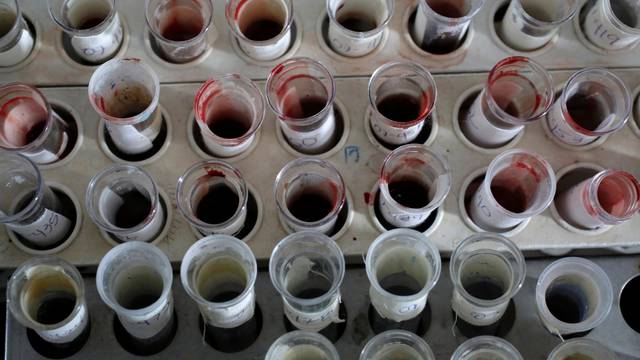 Testing tubes full of blood are seen during a blood donation at a school as part of the celebrations for Cuba's former President Fidel Castro's upcoming 90th birthday in Artemisa province, Cuba