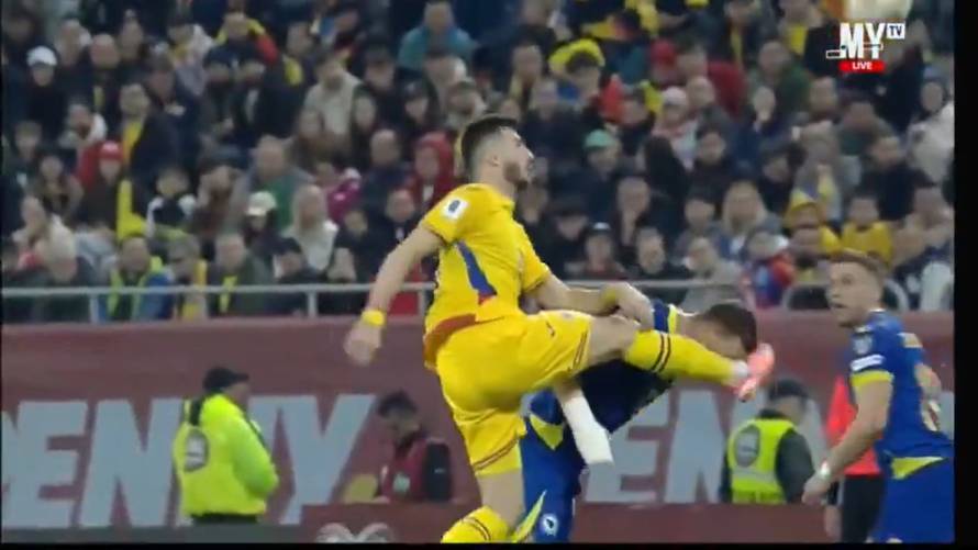 VIDEO Edinu Džeki slomili nos! Nakon utakmice se ipak našalio