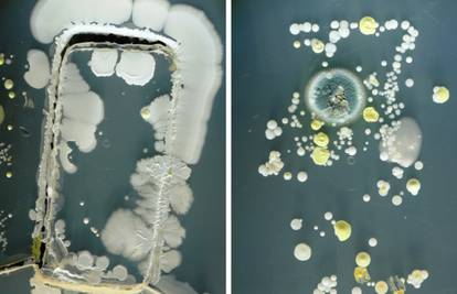 Konačno je dokazano: Vaš mobitel je rasadnik bakterija