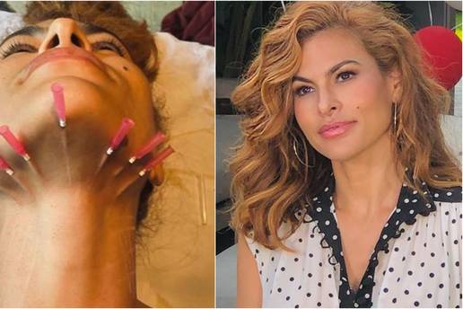 Strše joj igle iz vrata: Eva Mendes na anti-age tretmanu