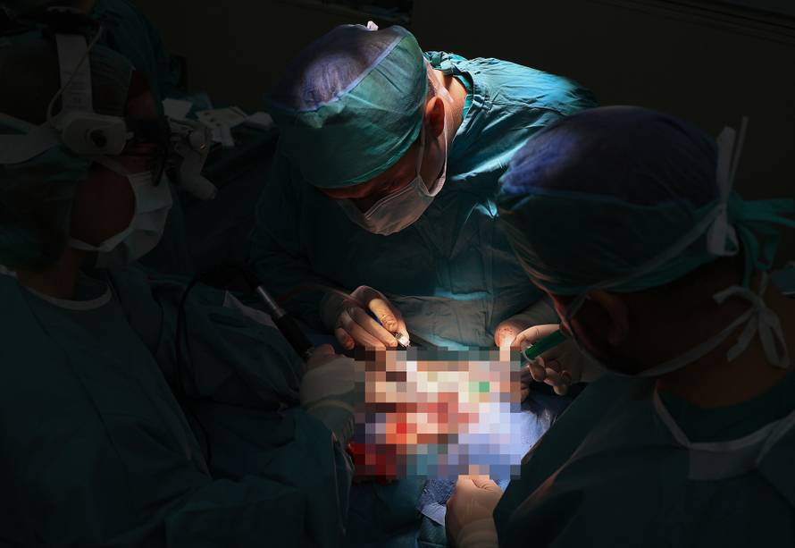 Specijalizantima u KB Dubrava kirurzi naplaćivali tečaj šivanja u bolnici: 'To je javna tajna'