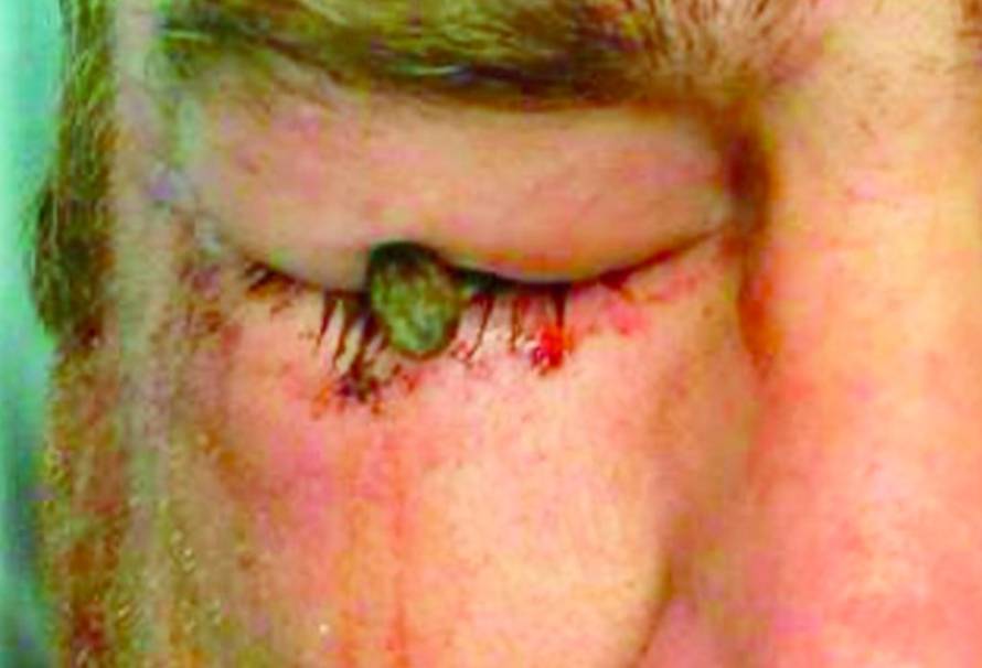 New England Journal of Medicine