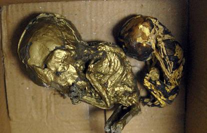 Krijumčario fetuse ukrašene zlatom za obrede crne magije