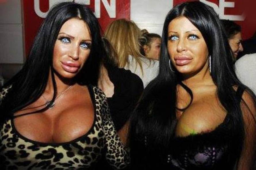 Sjećate li se srbijanske kraljice 'plastike'? Izvadila je silikone...