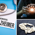 Američka FDA odobrila lijek za Alzheimer Leqembi, pitanje o nuspojavama ostaje aktualno