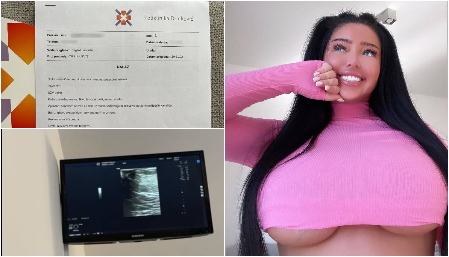 Slavonka Claudia ultrazvukom dokazala da su grudi prirodne, doktor: 'Kao od majke rođene!'