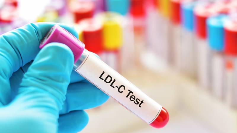 Evo koliko dugo je potrebno da se smanji razina kolesterola