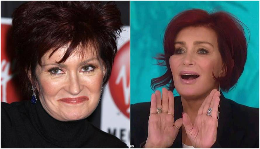 Osbourneova žena: 'Operacije su mi kao servis automobila'