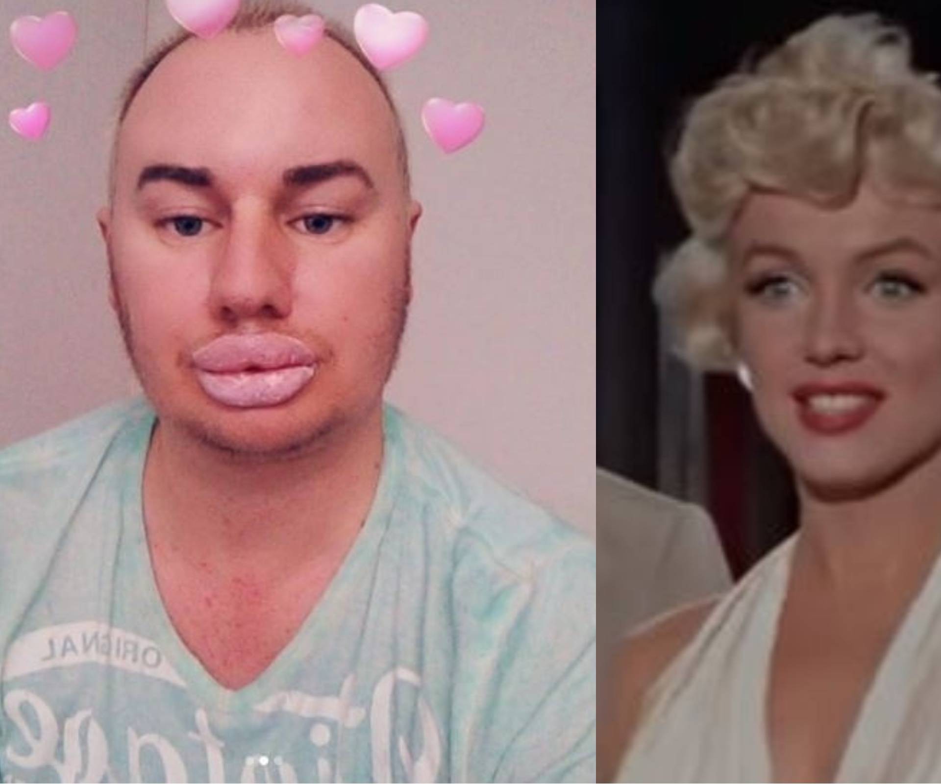 Prošao 20 tretmana: Želim biti kao moj idol Marilyn Monroe