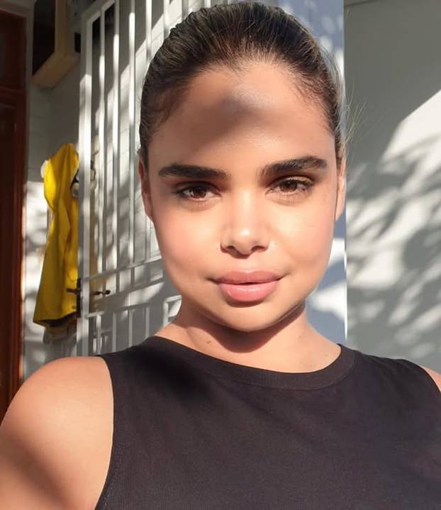 FOTO Influencerica i model: Bila sam na naslovnici Voguea, ali modeling krije tamnu stranu...