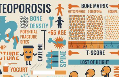 Čuvajte se: Osteoporoza jedna od 10 najčešćih bolesti danas