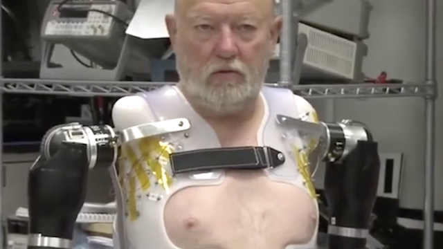 Dirljivo: Čovjek bez ruku prvi put isprobao robotske proteze