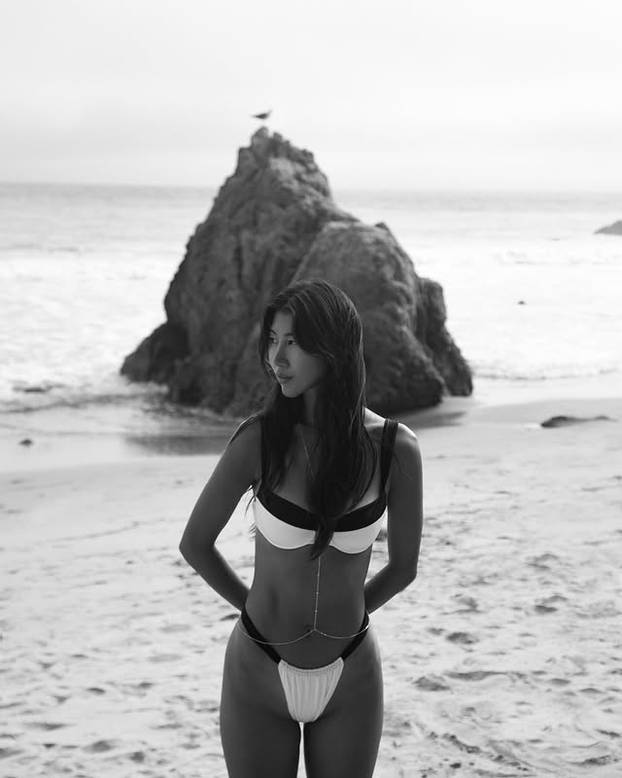 FOTO Mlada manekenka svoju 'nesigurnost' pretvorila u posao iz snova: 'To mi je najveći adut'