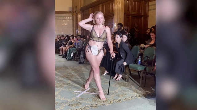 Na Londonskom tjednu mode prošetala torbicu za stomu: 'Bila sam tako ponosna...'