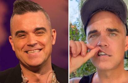 Robbie Williams ima nove zube: 'Stare sam uništio. Otvarao sam boce njima, pa kokain, kava...'