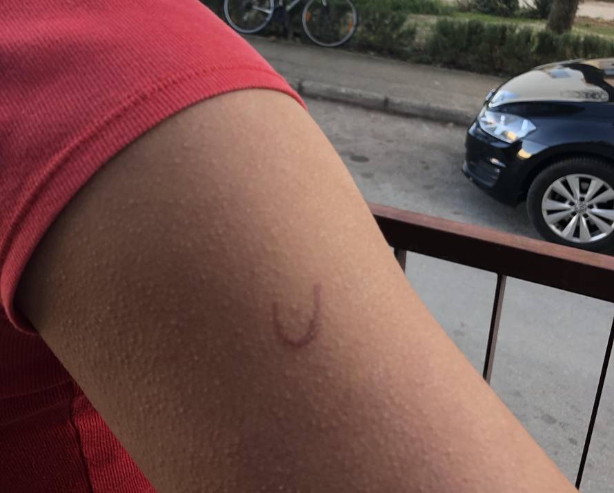 Napadnuta učenica: 'Ožiljak je možda trajan, loše se osjećam'