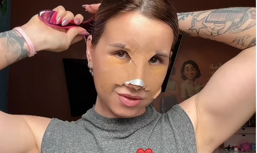 FOTO Sestra Stele Rade i&scaron;la na estetske zahvate: Pokazala je rezultate, evo kako izgleda...