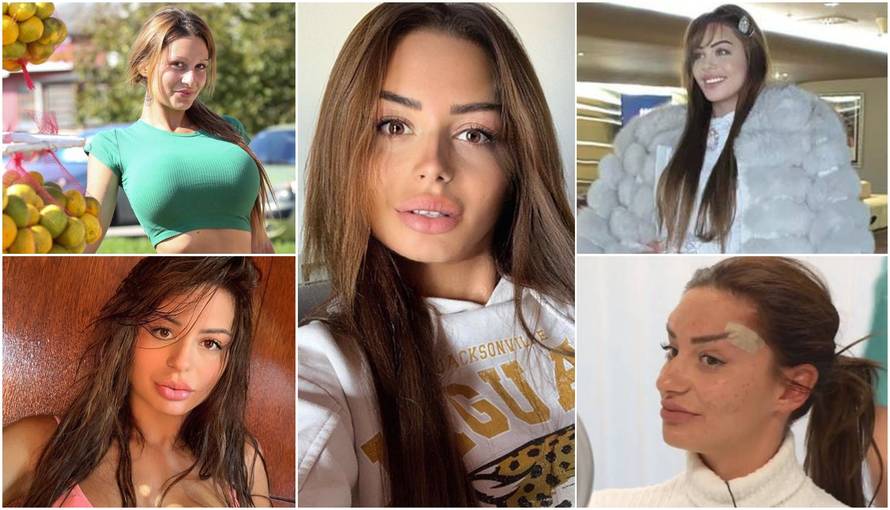 Ne sramim se estetskih zahvata, mislim da je to u redu. Sretno sam zaljubljena već pet godina