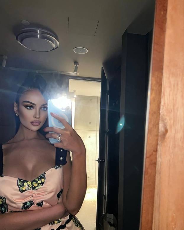 FOTO Brazilka Jennifer: Bila sam ovisna o estetskim zahvatima! Potrošila sam preko 800.000 $