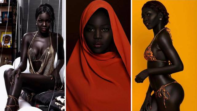 Kraljica tame: Predivan model iz Sudana i danas trpi uvrede