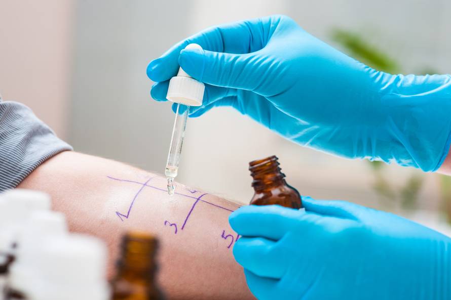 Antibiotici u dojenačkoj dobi dižu rizik od razvoja alergija