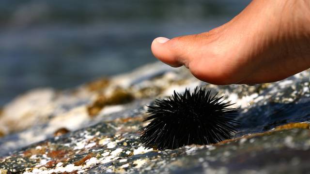 walk on a sea urchin