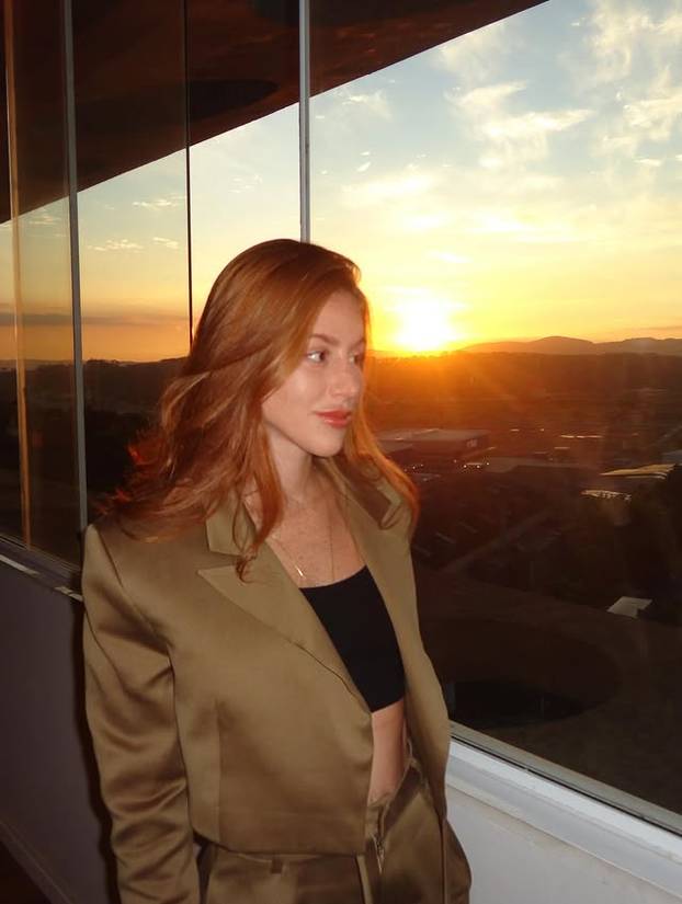 FOTO Posebna ljepota: Milijuni ljudi obožavaju njezine pjegice