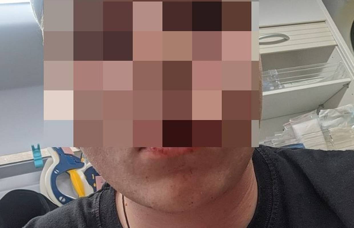 Napadač s veslom iz Umaga je bivši policajac koji je udaljen iz službe zbog povrede dužnosti