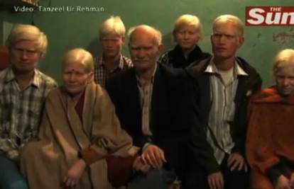 Obitelj iz Indije ima 10 članova i svi su albino: Žele priznanje