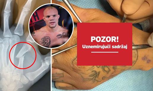 Lavlje srce i čelična šaka: UFC zvijezdi skoro amputirali prst