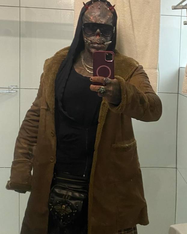 FOTO Uznemirujuće! Uklonila je čak i vrh nosa, a evo kako je izgledala: Šteta, ljepotica si bila